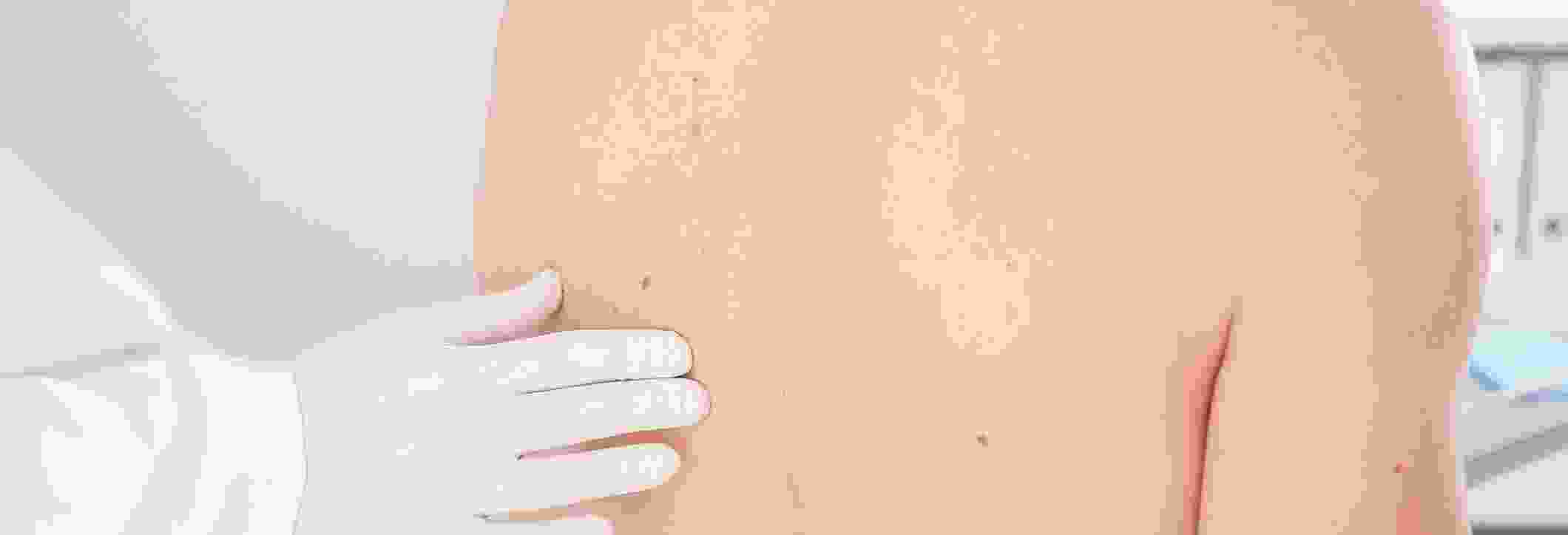 Skin Care